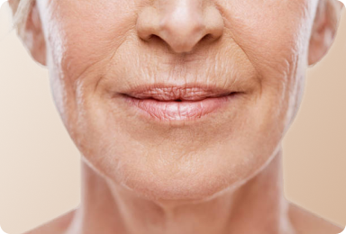 Fina linjer och rynkor